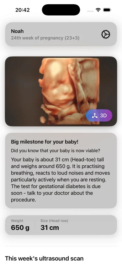ScanBaby on iPhone, showing weekly development and a 3D ultrasound image