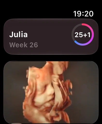 ScanBaby Apple Watch app showing pregnancy week 26 and a 3D baby view