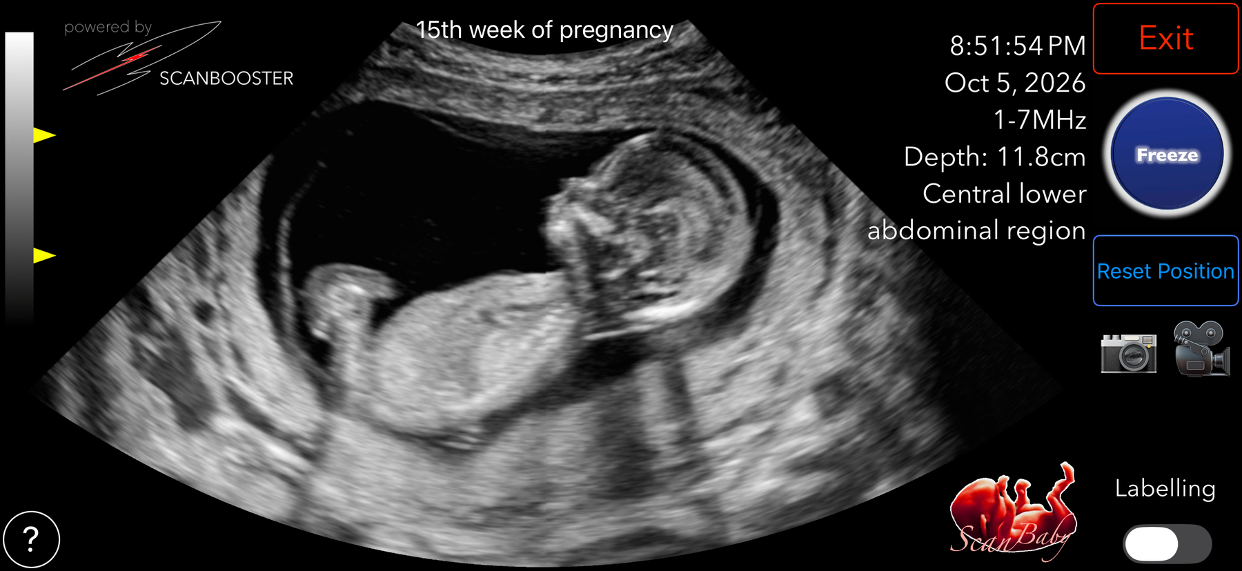 Unlabelled ultrasound image in the ScanBaby virtual exam