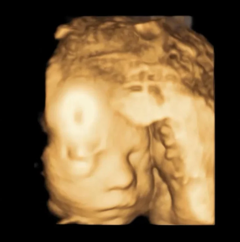Hello, little one · Week 28