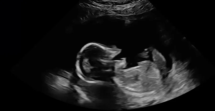 The tiniest yawn · Week 17