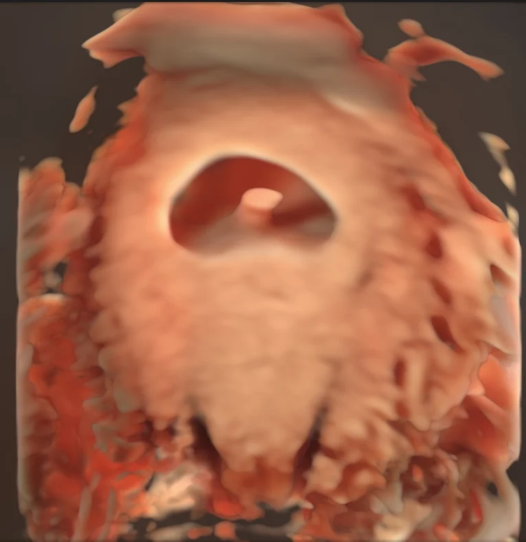 Original ScanBaby 3D view for week 8 of pregnancy
